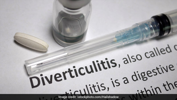 Colon Health: All You Need To Know About Diverticulitis; Diet Tips And More