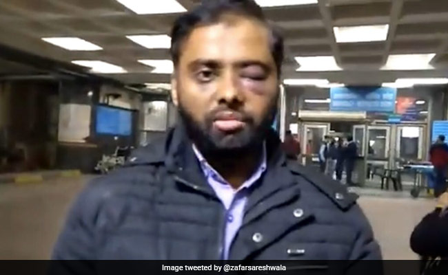"Don't Feel Safe On Campus Anymore": Jamia Student Who Lost Partial Vision In Clash