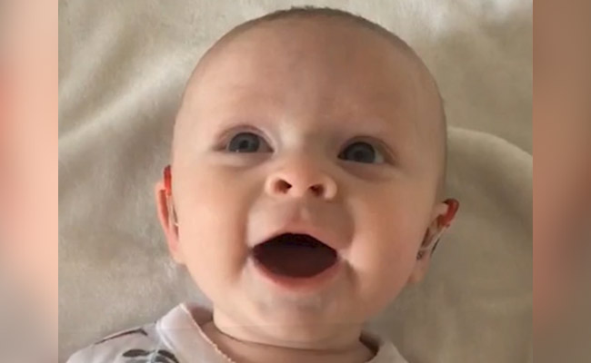 Video: Baby Smiles In Delight After Hearing Aids Are Turned On