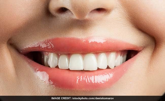 Teeth care in winter : दांतों पर है पीलापन, तो आजमाएं ये घरेलू नुस्खे, एकदम चमकने लगेंगे दांत