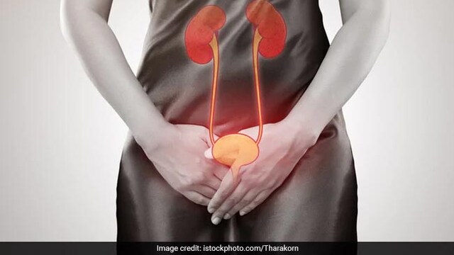 Urology: Simple precautions can help you prevent urological disorders