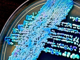 IIT Hyderabad Develops New Drug Delivery System To Treat Fungal Infections IIT Hyderabad Develops New Drug Delivery System To Treat Fungal Infections