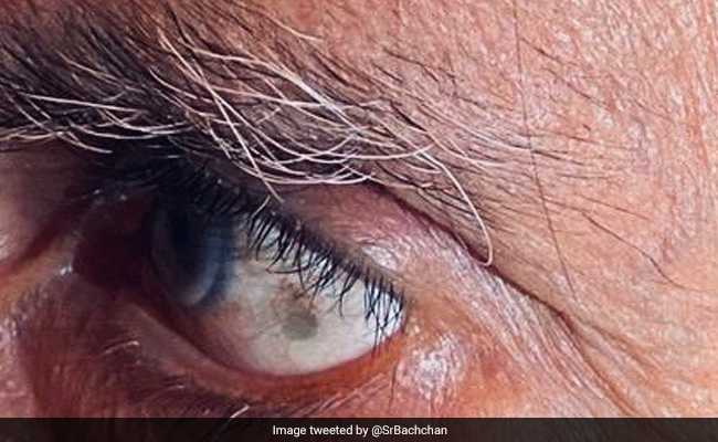 अमिताभ बच्चन को आंखों में दिखा काला धब्बा तो एक्टर को आ गई मां के पल्लू की याद- Tweet वायरल