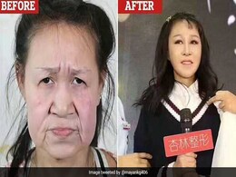 15 साल में बूढ़ी दिखने लगी थी लड़की, इस बीमारी से हुआ ये हाल, अब दिखने लगी जवान 15 साल में बूढ़ी दिखने लगी थी लड़की, इस बीमारी से हुआ ये हाल, अब दिखने लगी जवान