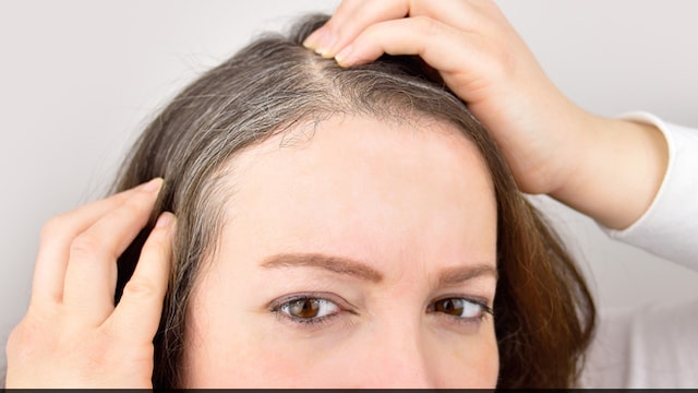Eating foods high in vitamins and antioxidants can slow down greying of hair