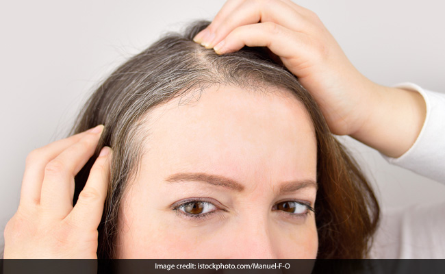 Hair care: Nutritional deficiencies can lead to premature greying of hair