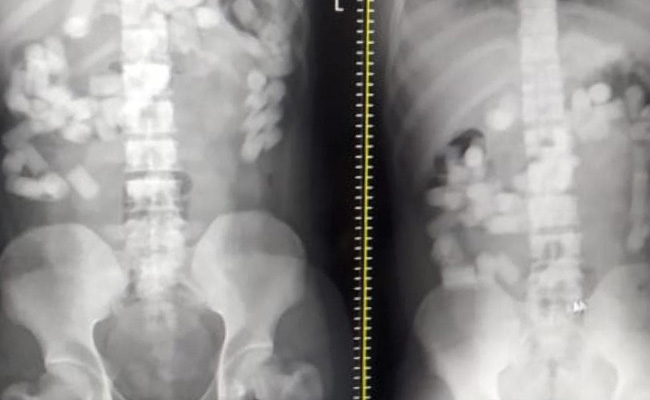 पेट में छुपा रखी थी 1 किलो से भी ज्यादा हेरोइन, दिल्ली में सप्लाई करने आए 7 अफगानी गिरफ्तार