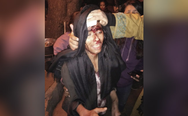 As JNU Student Leader Was Bleeding, 2 Cases Against Her Within 4 Minutes