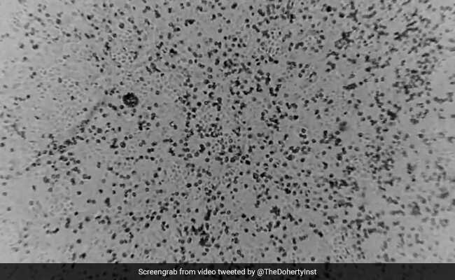 कोरोनावायरस की जांच के लिए दिल्‍ली में जल्‍द बनेंगे 10 और लैब