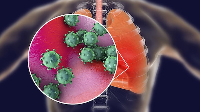 Coronavirus affects the respiratory tract of the infected person