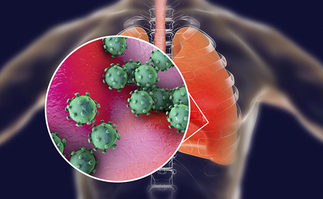 Coronavirus affects the respiratory tract of the infected person