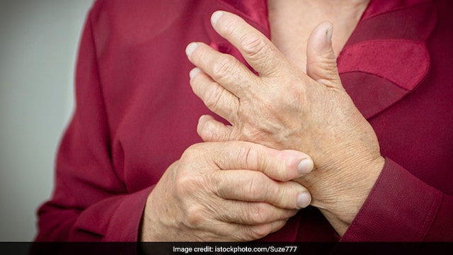 Rheumatoid Arthritis Awareness Day 2024: Over time, rheumatoid arthritis can cause joint deformities