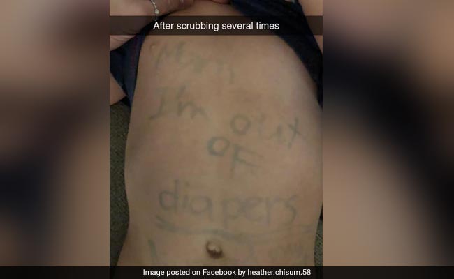 मां नहीं देखती थी रिपोर्ट तो डे केयर टीचर ने बच्चे के पेट पर ही लिख दिया नोट और फिर... देखें Viral Photo