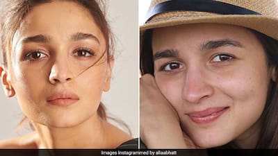 alia bhatt glutathione Here's What You Need To Get Glowing Skin Like Alia Bhatt