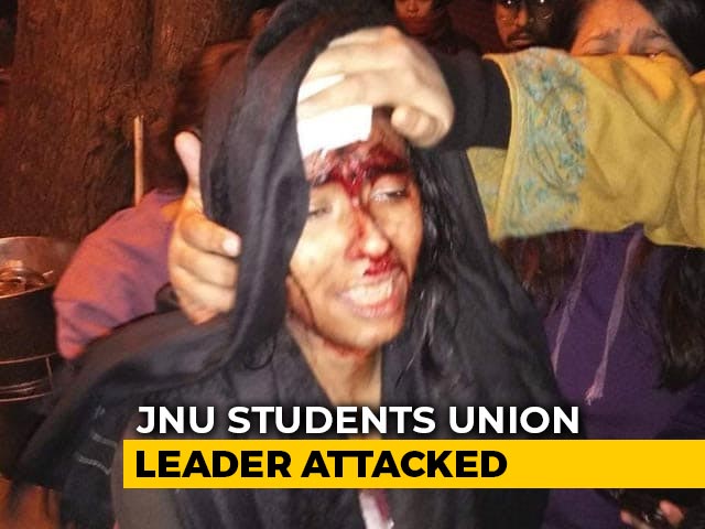 Watch: "I Am Bleeding," Says Badly Injured JNU Students' Union President