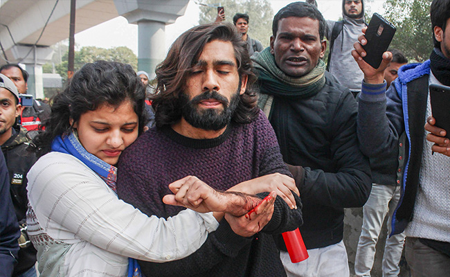 Jamia Student Hurt In Shooting Says University As Much To Blame As Cops