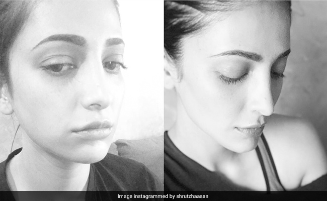 "This Is My Life, My Face": Shruti Haasan On Body Shaming, Plastic Surgery And Hormonal Pain