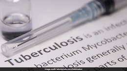 25-44 Age Group Records Highest Tuberculosis-Linked Deaths in Delhi: Report