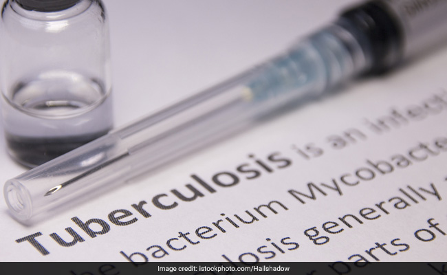 World Tuberculosis (TB) Day: Avoid smoking and secondhand smoke, as they weaken lung defences