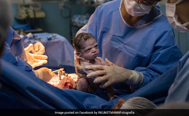 जन्म के बाद डॉक्टर ने मारा तो गुस्से से देखने लगी बच्ची, सोशल मीडिया पर हुई Memes की बरसात