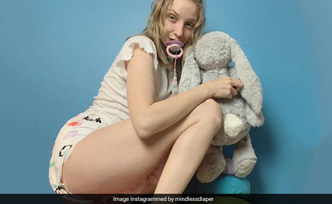 25 साल की ये लड़की रहती है बच्‍चों की तरह, पहनती है डायपर और गुड़‍ियों के साथ बिताती है पूरा दिन, देखें Photos