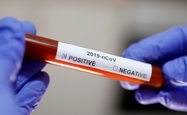 About 250 Indians Infected By Coronavirus In Singapore: High Commission