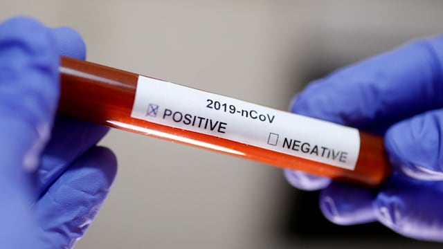 The available data are thin and results from COVID-19 patients are murky