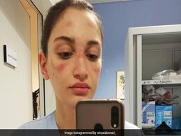 Coronavirus पीड़ितों का इलाज कर रही नर्स ने बताई मेडिकल प्रोफेशनल्स की हकीकत, लिखा- ''मैं भी...'' Coronavirus पीड़ितों का इलाज कर रही नर्स ने बताई मेडिकल प्रोफेशनल्स की हकीकत, लिखा- ''मैं भी...''