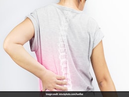 World TB Day 2020: Here's Everything You Need To Know About Spinal Tuberculosis World TB Day 2020: Here's Everything You Need To Know About Spinal Tuberculosis