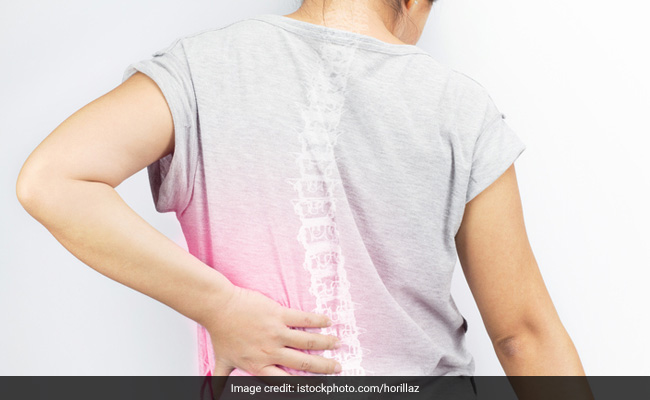 World TB Day: Surgery is needed only in about 20% of the cases in cases of spinal TB