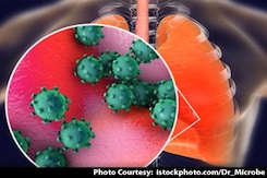 Coronavirus Outbreak: Symptoms Of COVID-19 Coronavirus Outbreak: Symptoms Of COVID-19