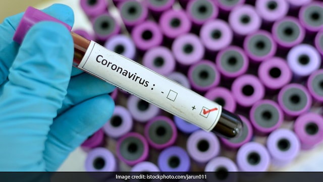 Coronavirus: In case of respiratory symptoms, self-quarantine first instead of rushing to the hospital
