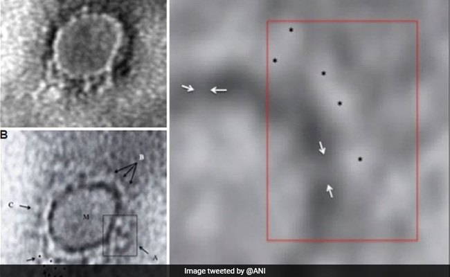 First Electron Microscope Image Of COVID-19 Virus From India Released