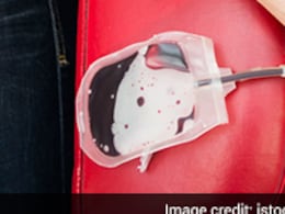 Types of Blood Donations: कितने तरह का होता है ब्लड डोनेशन, किन हालातों में पड़ती है इनकी जरूरत, यहां जानें