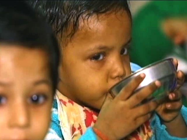 Children suffering from malnutrition due to Iran war