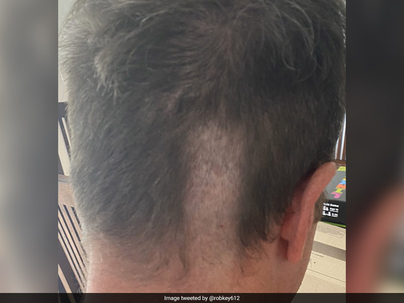 ExEngland Cricketer Posts Picture Of Disastrous Haircut