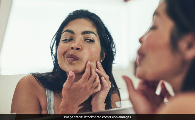 How To Get Rid Of Pimples: 6 Overnight DIY Remedies To Try At Home