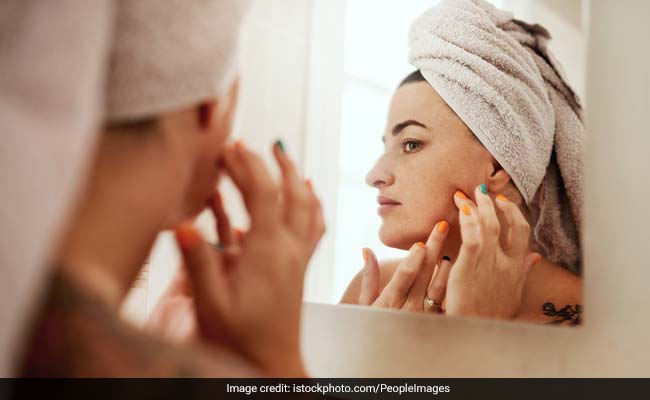 How To Remove White Spots From Face Causes Steps To Follow How To Remove White Spots From Face Causes Steps To Follow