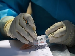 33-Year-Old Journalist Dies Of Coronavirus In Telangana 33-Year-Old Journalist Dies Of Coronavirus In Telangana