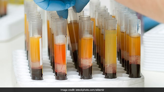 Plasma therapy: ICMR, DGCI are working to give approvals for it in critically ill COVID-19 patients