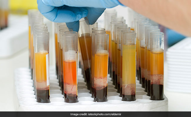 Plasma therapy: ICMR, DGCI are working to give approvals for it in critically ill COVID-19 patients