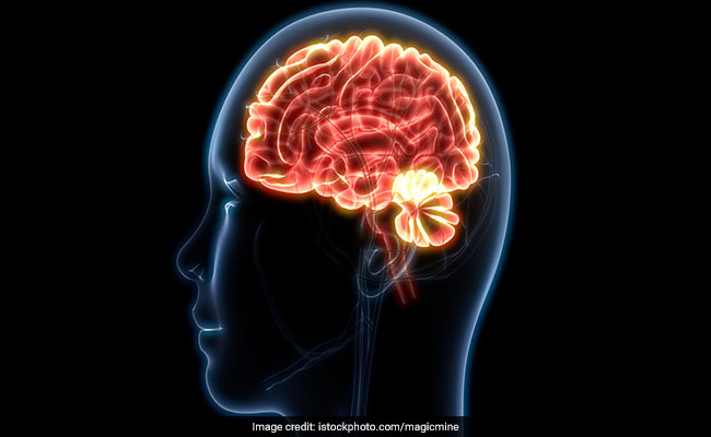 Want A Healthy Brain? These Lifestyle Tips Are What You Need To Follow