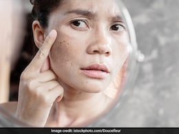 डार्क सर्कल, मुहांसे और पिगमेंटेशन हो सकती है ठीक, बस रोज रात को सोने से पहले लगा लें इस सब्जी का रस डार्क सर्कल, मुहांसे और पिगमेंटेशन हो सकती है ठीक, बस रोज रात को सोने से पहले लगा लें इस सब्जी का रस
