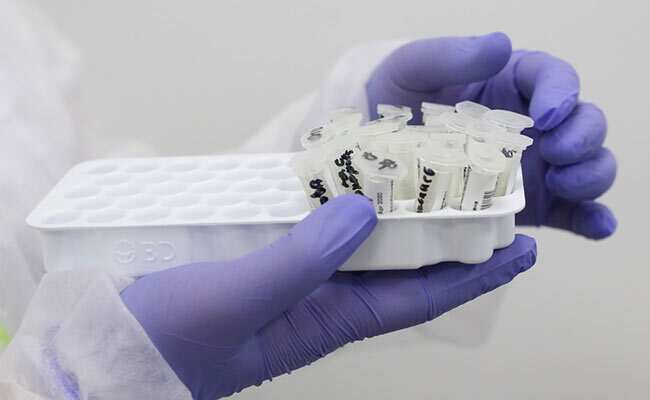 COVID-19: क्यों हो रही है महिलाओं से ज्यादा पुरुषों की मौत, अध्ययन में खुलासा