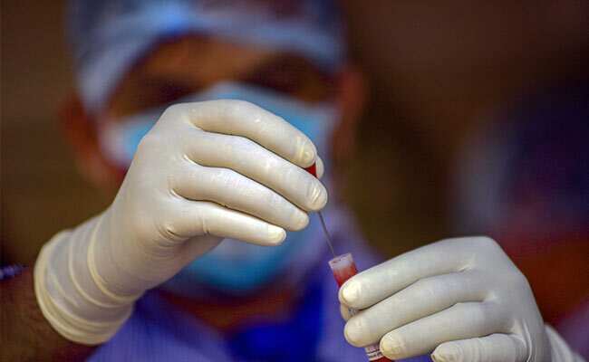 Coronavirus Cases In Up: उत्तर प्रदेश में कोविड-19 से 27 और मौतें, 24 घंटे में 1,746 नए मामले Coronavirus Cases In Up: उत्तर प्रदेश में कोविड-19 से 27 और मौतें, 24 घंटे में 1,746 नए मामले