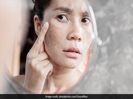 दाग-धब्बे हटाने में असर दिखाती हैं घर की कुछ चीजें, इस्तेमाल करके खुद देख सकते हैं असर दाग-धब्बे हटाने में असर दिखाती हैं घर की कुछ चीजें, इस्तेमाल करके खुद देख सकते हैं असर