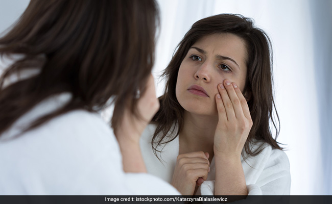 There can be many reasons for dark circles besides lack of sleep