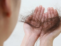 क्या आपके बाल भी कंघी करते ही गुच्छों में बाहर आ जाते हैं, किस विटामिन की कमी से बाल झड़ते हैं, जानें Hair Fall रोकने के 5 असरदार उपाय Recipe