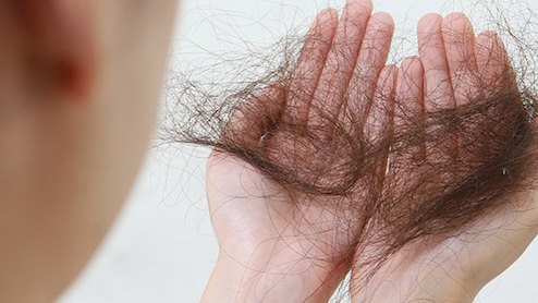 बालों का झड़ना कैसे बंद करें घरेलू उपाय? | सिर में हाथ डालते ही हाथ में आ जाता है बालों का गुच्छा, जान लें क्या खाने से बालों का गिरना होगा बंद