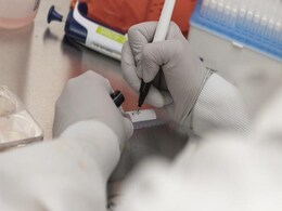 COVID-19: ओडिशा के अस्पताल में Covaxin का मानव परीक्षण शुरू COVID-19: ओडिशा के अस्पताल में Covaxin का मानव परीक्षण शुरू